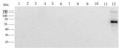 Western Blot: Human Coronavirus Spike Protein Antibody (15) [NBP3-14656]