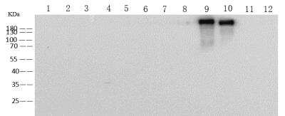 Western Blot: Human Coronavirus Spike Protein Antibody (23) [NBP3-14657]