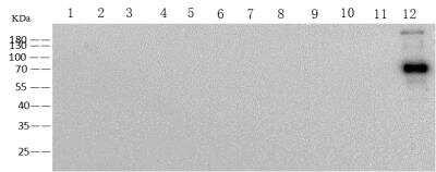 Western Blot: Human Coronavirus Spike Protein Antibody (29) [NBP3-14658]