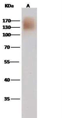 Western Blot: Human Coronavirus Spike Protein Antibody [NBP3-12727]