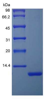 SDS-PAGE: Recombinant Human IGF-I/IGF-1 DES (1-3) Protein [NBP2-34947]