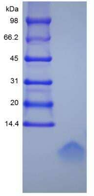 SDS-PAGE: Recombinant Human Defensin beta 1 Protein [NBP2-34906]