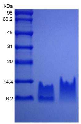 SDS-PAGE: Recombinant Human Defensin beta 2 Protein [NBP2-34910]