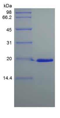 SDS-PAGE: Recombinant Human Desert Hedgehog C23II Protein [NBP2-34949]