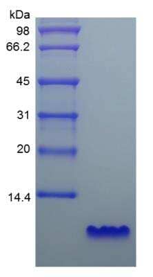 SDS-PAGE: Recombinant Human EGF Protein [NBP2-34952]