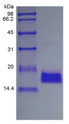 SDS-PAGE: Recombinant Human EMAP-II/AIMP1 Protein [NBP2-34954]