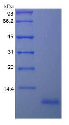 SDS-PAGE: Recombinant Human EPGN Protein [NBP2-34987]