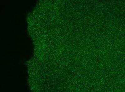 Immunocytochemistry/ Immunofluorescence: Human ESC Marker Antibody Pack [NBP1-42825]