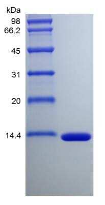 SDS-PAGE: Recombinant Human FABP6 Protein [NBP2-35006]