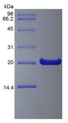 SDS-PAGE: Recombinant Human FGF-21 Protein [NBP2-35023]