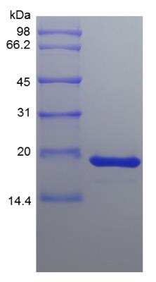 SDS-PAGE: Recombinant Human FGF-4 Protein [NBP2-34864]