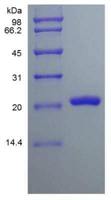 SDS-PAGE: Recombinant Human FGF-9 Protein [NBP2-34866]