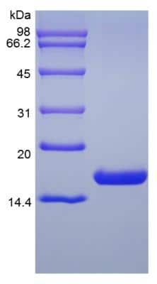 SDS-PAGE: Recombinant Human Flt-3 Ligand/FLT3L Protein [NBP2-34868]