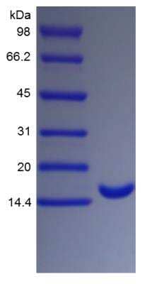 SDS-PAGE: Recombinant Human G-CSF Protein [NBP2-34884]