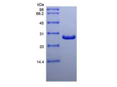 SDS-PAGE: Recombinant Human Galectin-3 Protein [NBP2-34881]