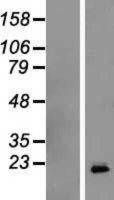 Western Blot: Growth Hormone Overexpression Lysate [NBL1-11063]