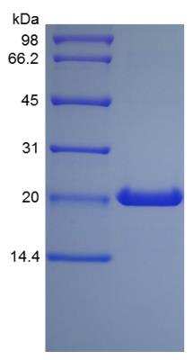 SDS-PAGE: Recombinant Human Growth Hormone Protein [NBP2-34890]