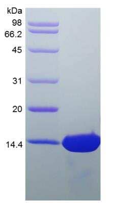 SDS-PAGE: Recombinant Human HB-EGF Protein [NBP2-34920]