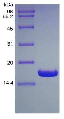 SDS-PAGE: Recombinant Human HR6B/UBE2B His (N-Term) Protein [NBP2-35088]