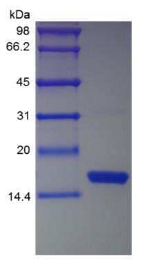 SDS-PAGE: Recombinant Human IFN-gamma Protein [NBP2-34992]