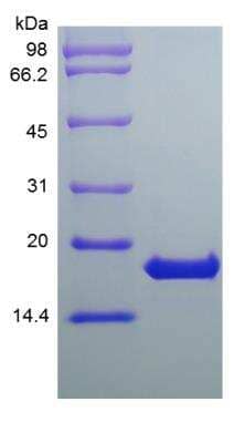 SDS-PAGE: Recombinant Human IFN-omega/IFNW1 Protein [NBP2-35893]