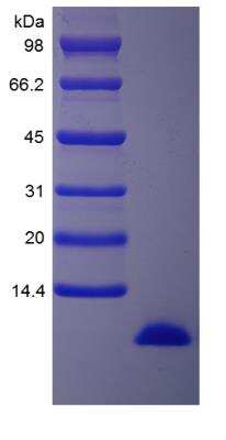 SDS-PAGE: Recombinant Human IGF-I/IGF-1 15N Stable Isotope Protein [NBP2-35896]