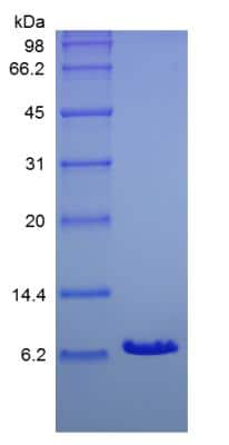 SDS-PAGE: Recombinant Human IGF-I/IGF-1 Protein [NBP2-35000]