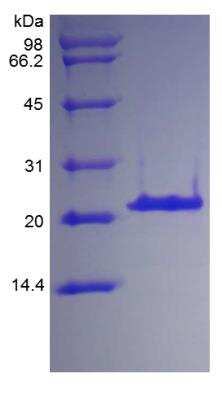 SDS-PAGE: Recombinant Human IGFBP-3 Protein [NBP2-35003]