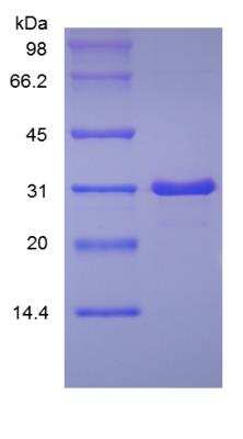 SDS-PAGE: Recombinant Human IGFBP-rp1/IGFBP-7 Protein [NBP2-35007]