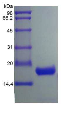 SDS-PAGE: Recombinant Human IL-10 Protein [NBP2-35015]