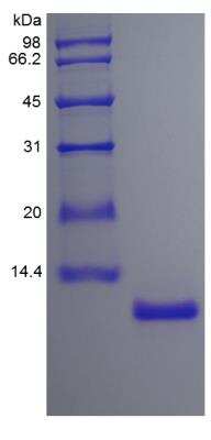 SDS-PAGE: Recombinant Human IL-15 Protein [NBP2-35020]