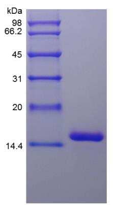 SDS-PAGE: Recombinant Human IL-16 Protein [NBP2-35029]