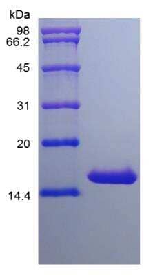 SDS-PAGE: Recombinant Human IL-16 Protein [NBP2-35032]