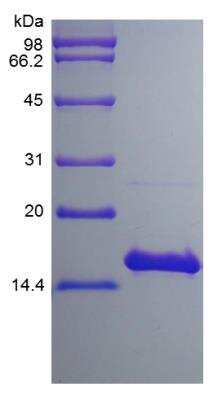 SDS-PAGE: Recombinant Human IL-17F Protein [NBP2-35046]