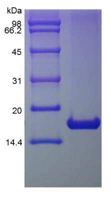 SDS-PAGE: Recombinant Human IL-1ra/IL-1F3/IL1RN Protein [NBP2-35894]