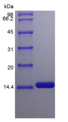 SDS-PAGE: Recombinant Human IL-2 Protein [NBP2-35054]