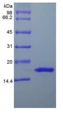 SDS-PAGE: Recombinant Human IL-20 Protein [NBP2-35056]