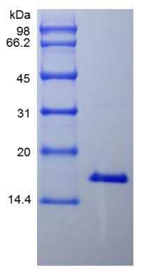 SDS-PAGE: Recombinant Human IL-21 Protein [NBP2-35057]