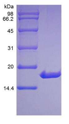 SDS-PAGE: Recombinant Human IL-33 Protein [NBP2-34871]