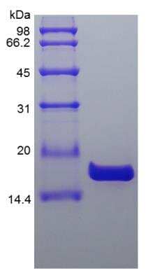 SDS-PAGE: Recombinant Human IL-36 beta/IL-1F8 Protein [NBP2-34882]