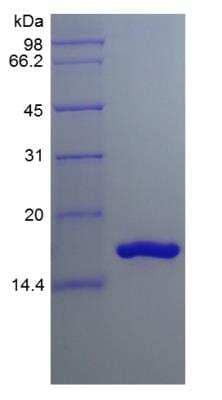 SDS-PAGE: Recombinant Human IL-36 beta/IL-1F8 Protein [NBP2-34887]