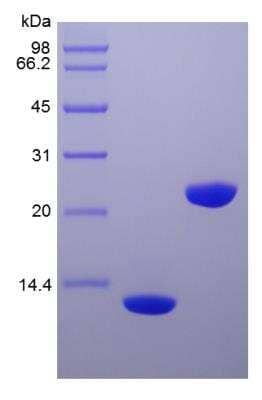 SDS-PAGE: Recombinant Human IL-5 Protein [NBP2-34897]