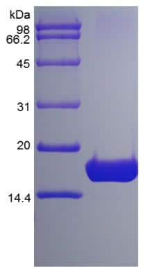 SDS-PAGE: Recombinant Human IL-7 Protein [NBP2-34902]