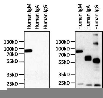 Human IgM: Antibodies