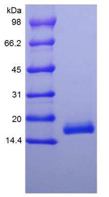 SDS-PAGE: Recombinant Human IFN-alpha 1 Protein [NBP2-35888]