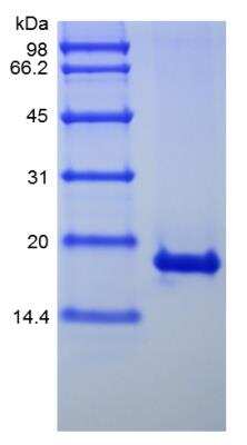 SDS-PAGE: Recombinant Human IFN-alpha 1 Protein [NBP2-35891]