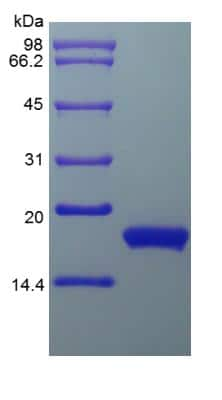 SDS-PAGE: Recombinant Human IFN-alpha 2 Protein [NBP2-34971]