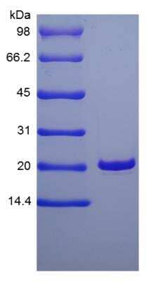 SDS-PAGE: Recombinant Human KGF/FGF-7 Protein [NBP2-34924]