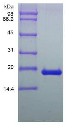 SDS-PAGE: Recombinant Human LIF Protein [NBP2-34935]