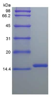 SDS-PAGE: Recombinant Human Leptin/OB Protein [NBP2-34934]